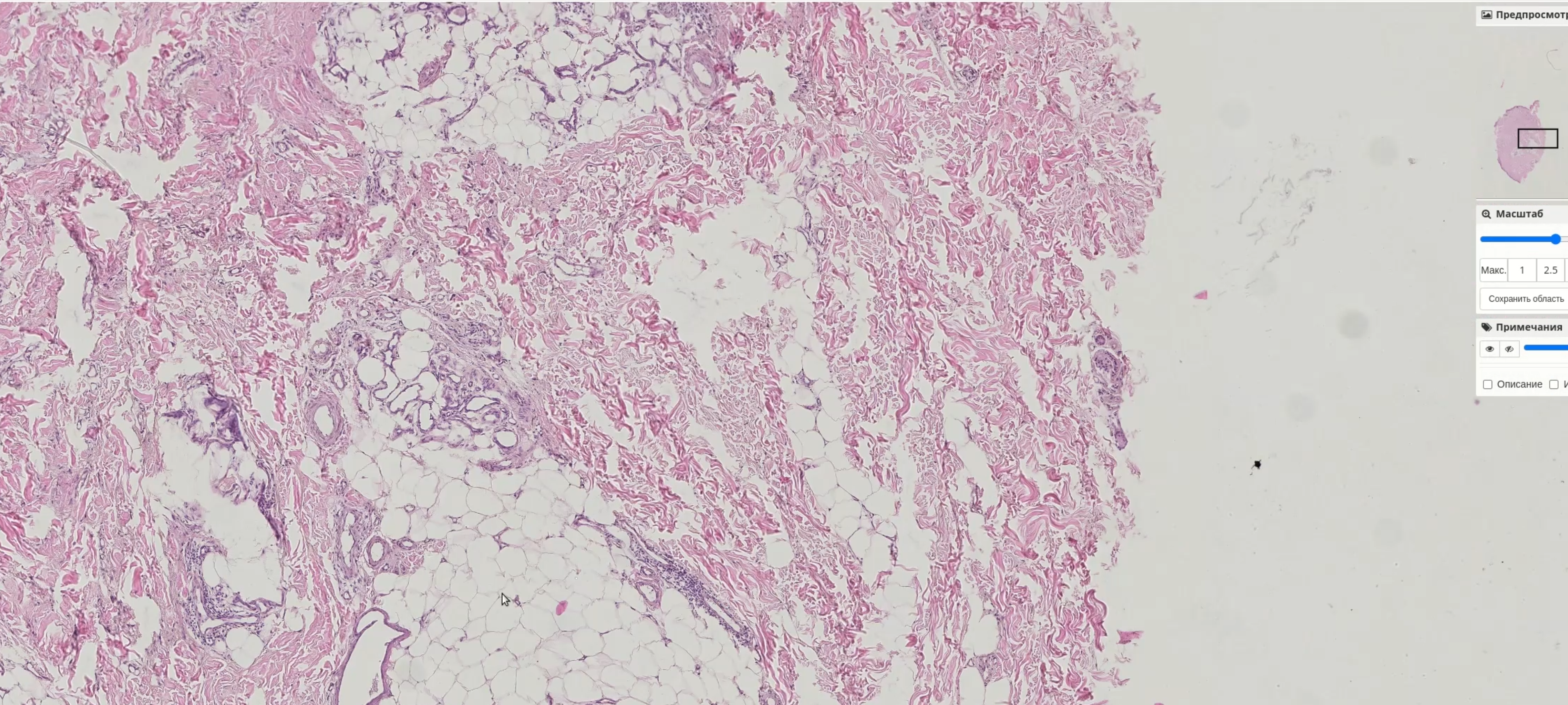 Kometa Pathology PACS — 1